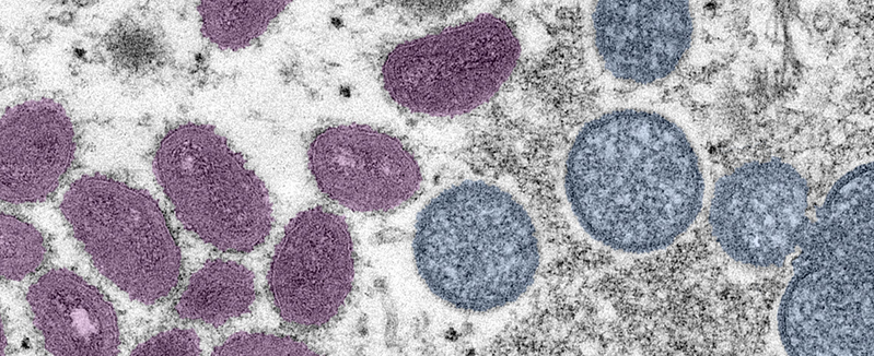 Monkeypox: OHA studies first childhood case in Oregon | Information 1 October 2, 2022 monkey pox